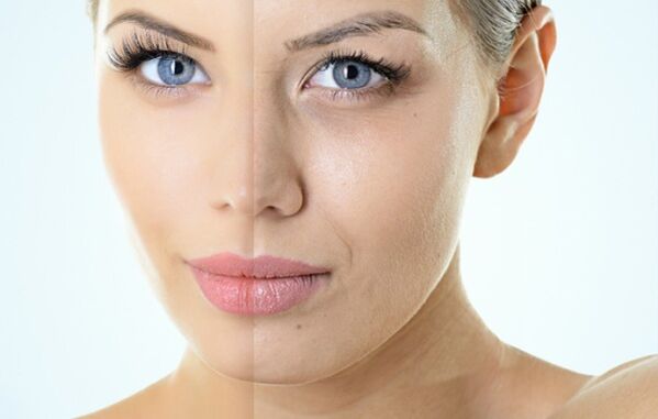 Indikācijas par frakcionētu atjaunošanos